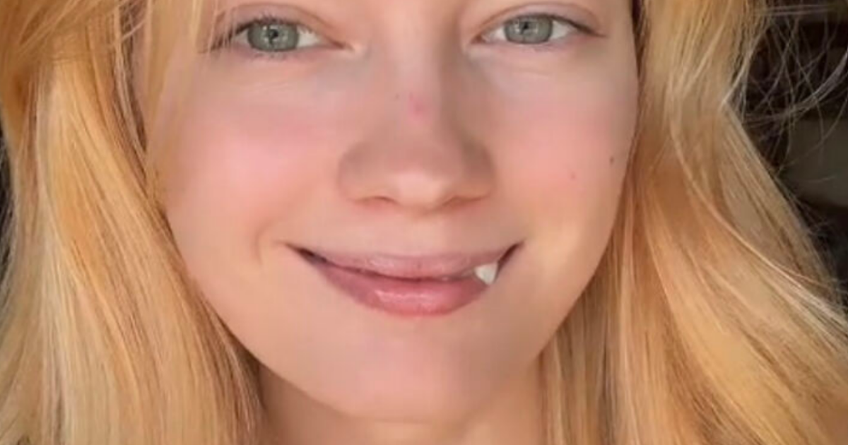 48 People Proudly Share Their Perfect Imperfections In This Wholesome TikTok Trend