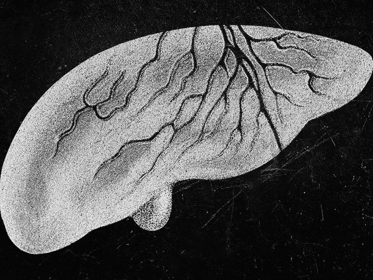 Alcoholic Hepatitis: Symptoms, Causes, Risks, and Treatment