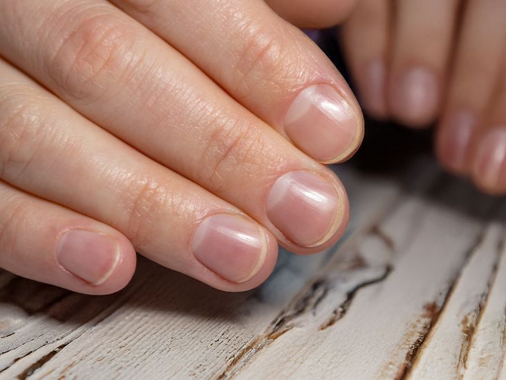 Half Moon Nails: Why You Do or Don’t Have It, Symptoms to Watch For